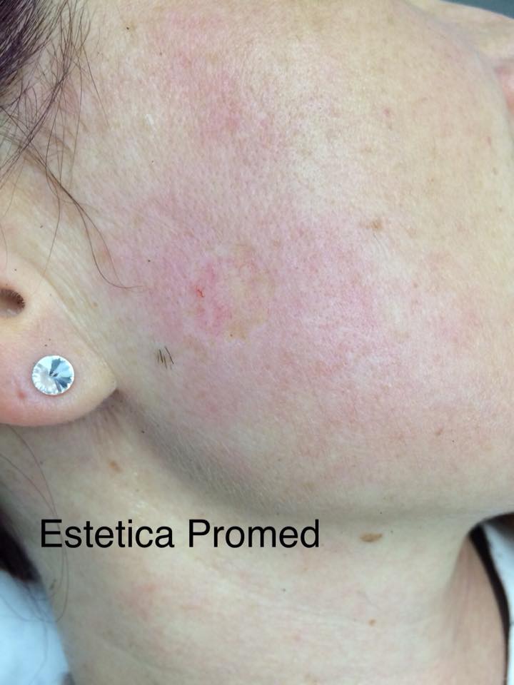 estetica promed.pl plasma